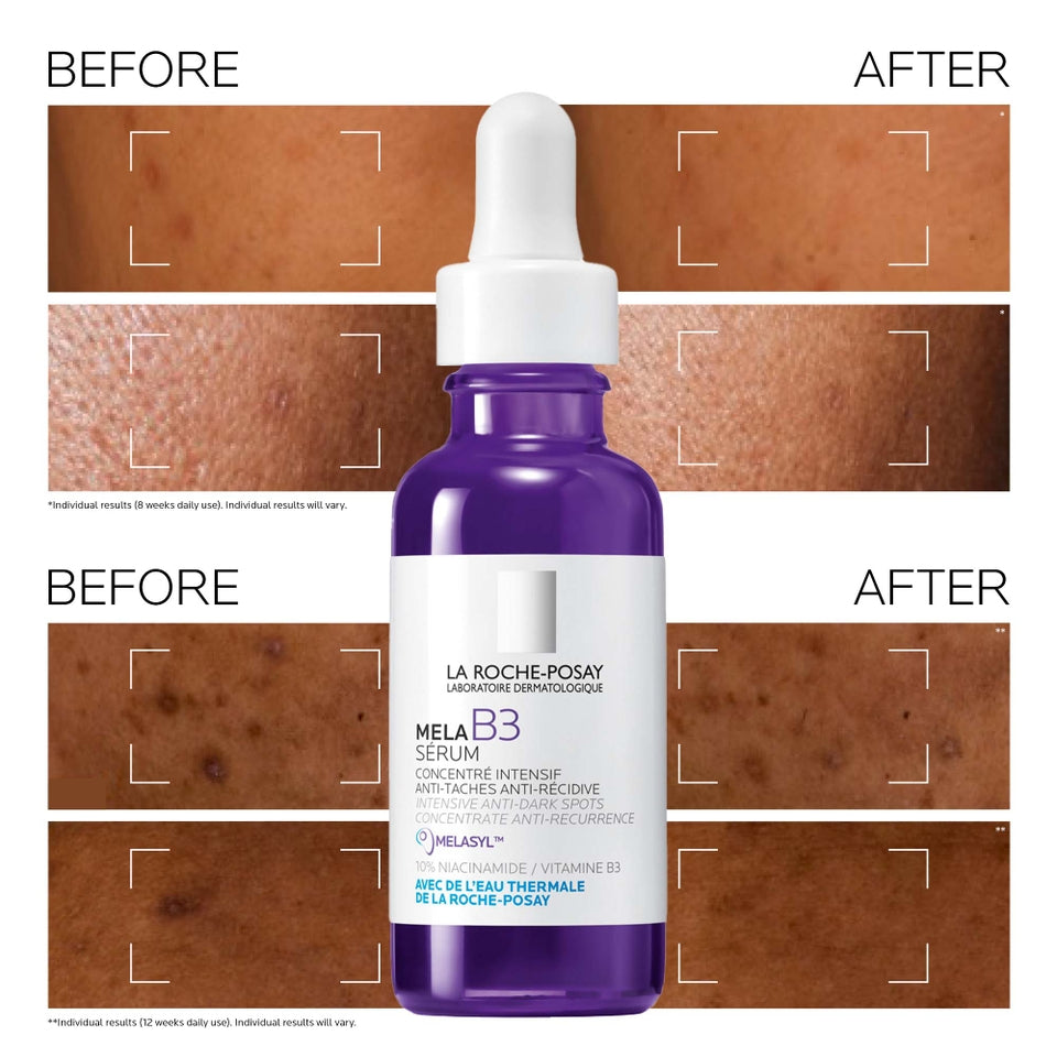 La Roche-Posay Melab3 Serum Intense Anti-Dark Spot For Hyperpigmentation 30Ml