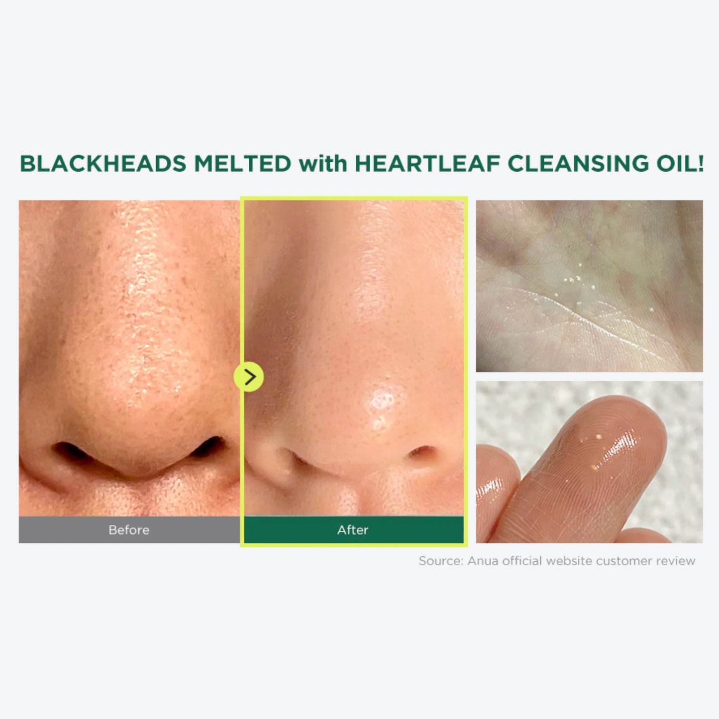 Anua Heartleaf Pore Control Cleansing Oil 200Ml